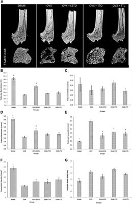 Osteoprotective Effects in Postmenopausal Osteoporosis Rat Model: Oral <mark class="highlighted">Tocotrienol</mark> vs. Intraosseous Injection of <mark class="highlighted">Tocotrienol</mark>-Poly Lactic-Co-Glycolic Acid Combination